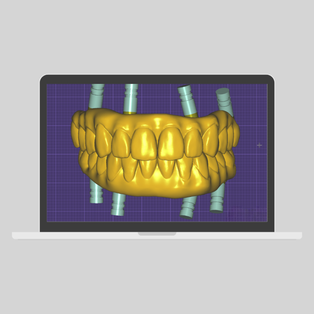 Exocad Software S.I.N. 360